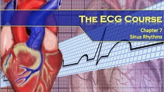 The ECG Course  Sinus Rhythms [upl. by Nylaroc]