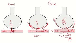 Diffuse Parenchymal Lung Disease ILD and Occupational Lung Disease Part 1 [upl. by Jania]