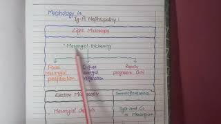 IgA Nephropathy  Pathology [upl. by Edurtreg]