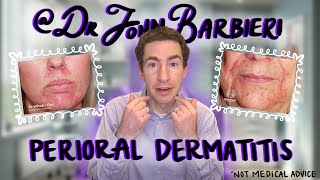 Dermatologist Explains Perioral Dermatitis How to Identify Causes amp Treatment [upl. by Koh697]