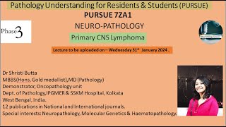 Pursue 7 Z A1 Primary CNS Lymphoma [upl. by Ataymik870]