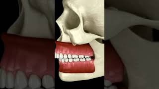 The Difference Between Overbite and Underbite [upl. by Sotos]