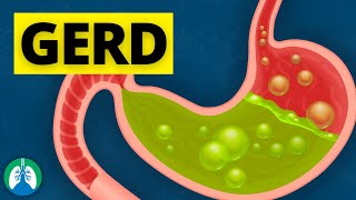 What Causes GERD [upl. by Adni]