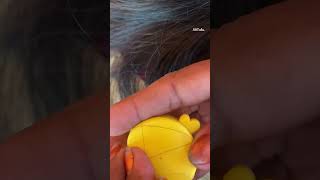 ASMR Lice and Nits Removal for Ultimate Scalp Check  Satisfying [upl. by Anirpas241]