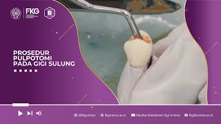 Prosedur PULPOTOMI Pada Gigi Sulung [upl. by Zasuwa499]