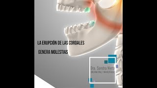 Extracción de Cordales  Dra Sandra Nieto Cirujana Oral y Maxilofacial [upl. by Damek]