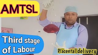 Third stage of labourPlacental deliveryAMTSL placenta delivery health nursing viralvideo gk [upl. by Oloapnaig]