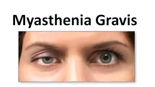 Myasthenia Gravis [upl. by Nerek]