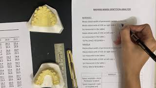 Moyers Mixed Dentition Analysis [upl. by Erda18]