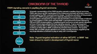 Usmle pathology webinar on Thyroid Neoplasms  Benign and Malignant types in Detail [upl. by Haynes366]