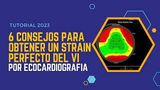 🚀Seis consejos para obtener un 💪STRAIN PERFECTO por ECOCARDIOGRAFÍA [upl. by Yun251]