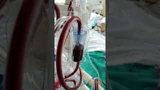 CRRT Continuous Renal Replacement Therapy [upl. by Hamimej]