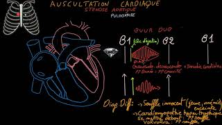 Auscultation cardiaque  Souffles cardiaquesbruits surajoutésExercices  Partie 2 Docteur Synapse [upl. by Alfy]