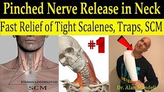 Wicked Neck Stretch for Fast Relief of Tight SCM Trap Scalene amp Pinched Nerve  Dr Mandell DC [upl. by Darleen]