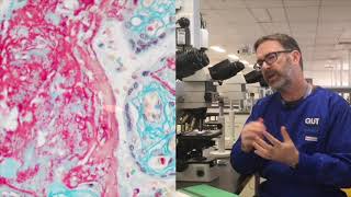 Microscope tutorial  Troubleshooting the MSB stain [upl. by Mcmaster]