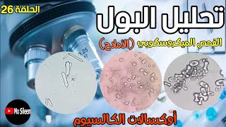 Urinalysis 26 microscopic ex crystals Calcium oxalate [upl. by Oswal178]