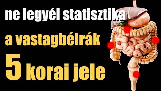 Ne kerülj a statisztikába ismerd meg a vastagbélrák 5 korai jelét [upl. by Pall]