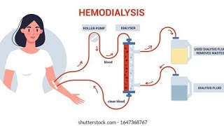 Dialysis and its type by Lecturer Rizwana Naseem [upl. by Yadrahc]