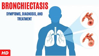 Bronchiectasis Symptoms Diagnosis and Treatment [upl. by Fagaly]