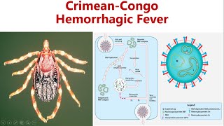 CrimeanCongo Hemorrhagic fever  CCHF  Cause Symptoms Diagnosis amp Prevention of CCHF [upl. by Notned]