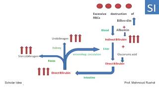 Hemolytic hepatic and obstructive Jaundice explained [upl. by Aiveneg]