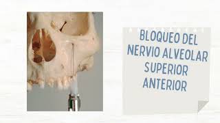 Tecnicas de Anestesia Maxilar y Mandibular [upl. by Revell]