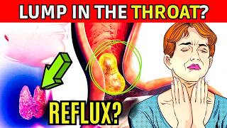 Feeling of HAVING A LUMP IN THE THROAT CLEARING YOUR THROAT and COUGH Could it be REFLUX [upl. by Ahsiak]