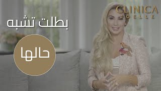 أكثر من سنتين لتغيير شكل بتول بشكل كلي [upl. by Ani257]