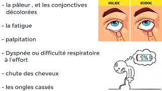 Quelle sont les symptomes danemie ferriprive macrocytaire hémolytique et traitement [upl. by Elmajian]