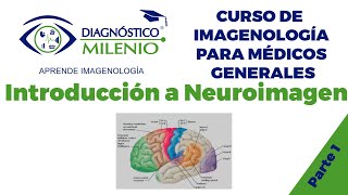 Introducción a Neuroimagen  Parte 1 [upl. by Aiken]