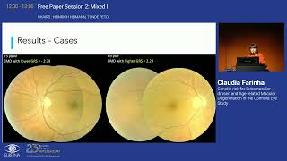 2 Genetic risk for Extramacular drusen and Agerelated Macular Degeneration in the Coimbra Eye Stud [upl. by Melac522]