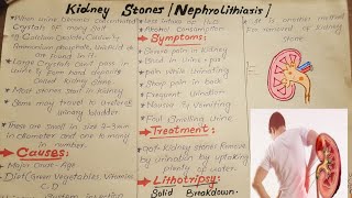 Kidney stonesNephrolithiasisCausesSymptoms and Treatmenteducationalvideoseducation [upl. by Now]