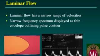 Carotid Sonography Doppler Evaluation and Waveform Analysis [upl. by Solenne113]