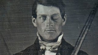 Why Scientists Are Still Fascinated By Phineas Gage [upl. by Eckblad]