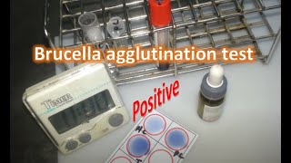 Brucella rapid agglutination test [upl. by Ahsaf]