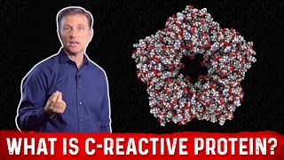 What is CReactive Protein amp How to Lower it – Dr Berg [upl. by Allayne]