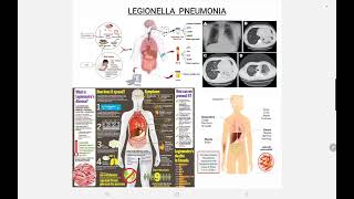 Legionella Pneumonia [upl. by Trevor]