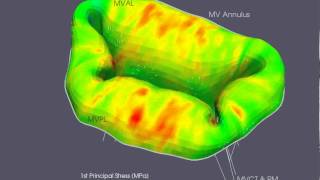 Mitral Valve Simulation [upl. by Lorak]