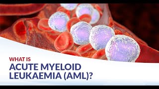 Acute Myeloid Leukemia AML Symptoms and Causes  Diagnosis  Treatment  Prevention [upl. by Adnorat]