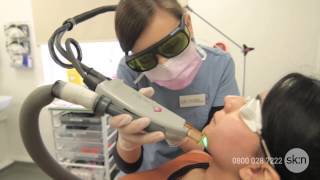 Laser Hair Removal  How does it work [upl. by Sallad]