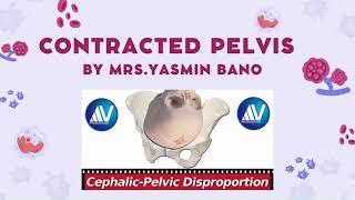 contracted pelvis and CPD [upl. by Tolkan]