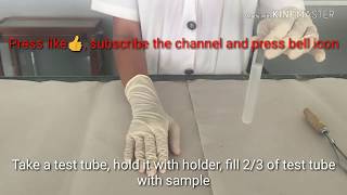 Heat coagulation test  detection of albumin in urine [upl. by Hallagan64]