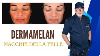 DERMAMELAN addio alle macchie della pelle [upl. by Thane767]