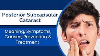 Posterior Subcapsular Cataract Meaning Symptoms Causes Prevention amp Treatment  All about PSC [upl. by Ardys]