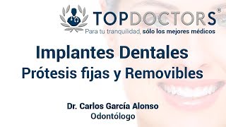 Implantes Dentales Prótesis fijas y Removibles [upl. by Atiseret]