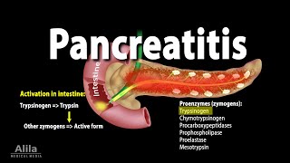 Pancreatitis Acute and Chronic Animation [upl. by Ikilisav]