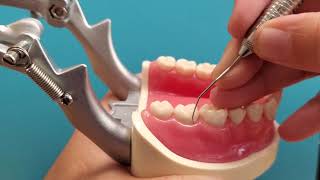 Exploring Posterior Teeth [upl. by Weider937]