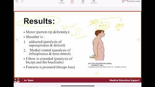 Brachial plexus injury [upl. by Christos]