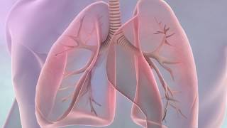 Symptoms of lung cancer [upl. by Hgieloj581]