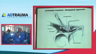 Introduction to ilioinguinal approach Prof Hazem Abdelazeem [upl. by Chloris]